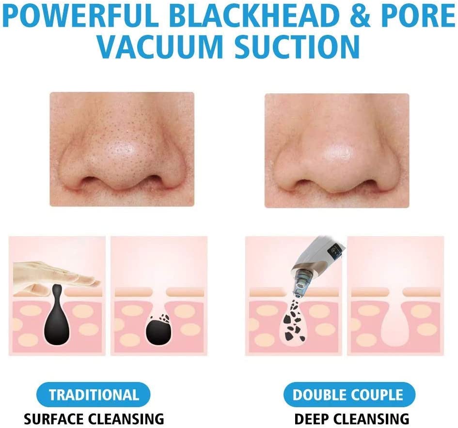 Original 5 in 1 Multi-functional Black Head Remover machine